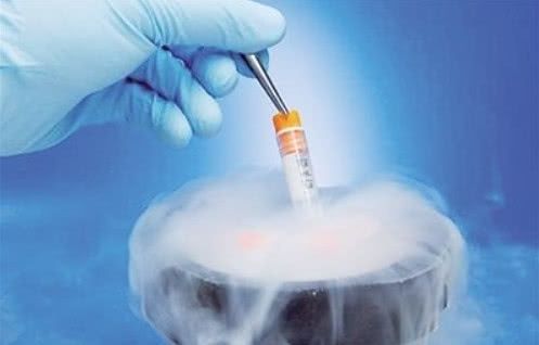 试管婴儿胚胎冷冻技术