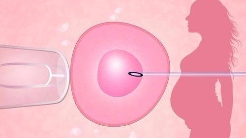 供卵做试管婴儿胚胎移植有哪些类型？