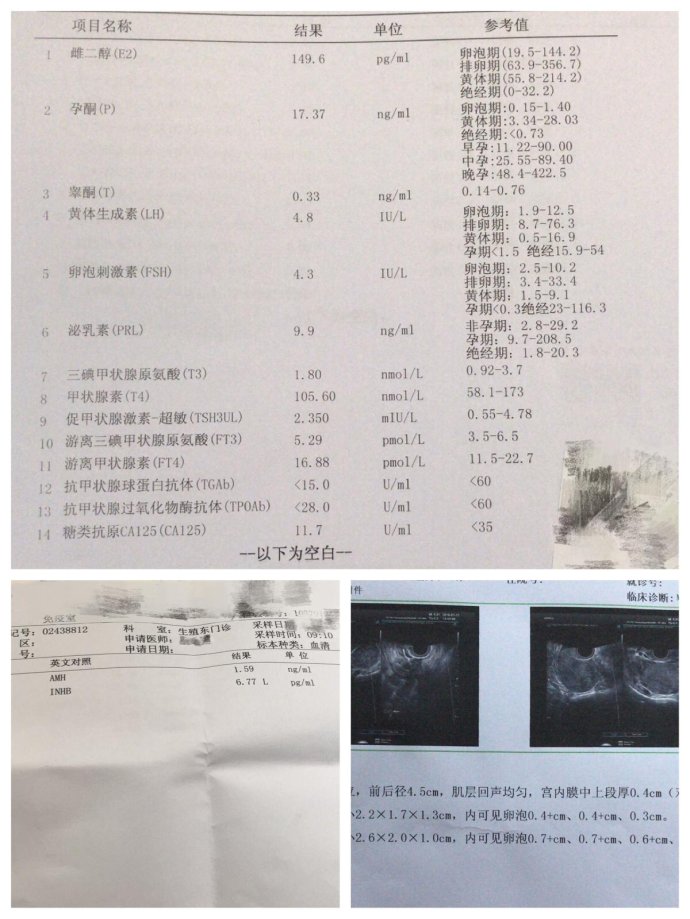 养囊只剩一个男胚,移植一次成功!