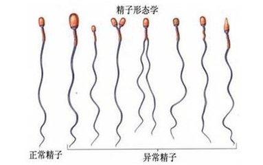正常的男性精液中的精子都存在畸形情况，但畸形率一般小于50%