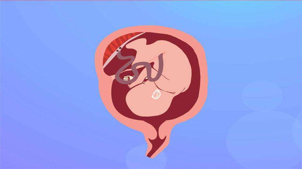 什么是子宫内膜?