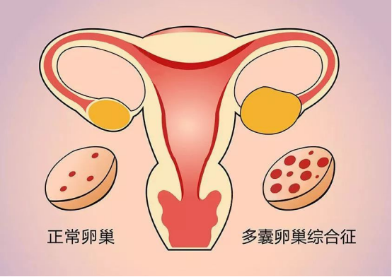 女性卵巢功能会影响泰国试管吗